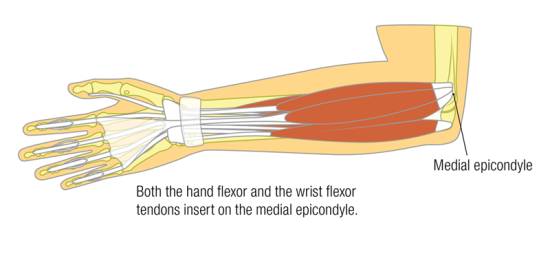 2D drawing of the hand flexor, wrist flexor, all the way to the medial epicondyle of the elbow.