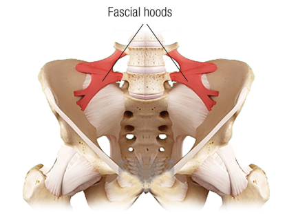 Fascial hoods on either side of the ilium over the L4 and L5 nerve roots.