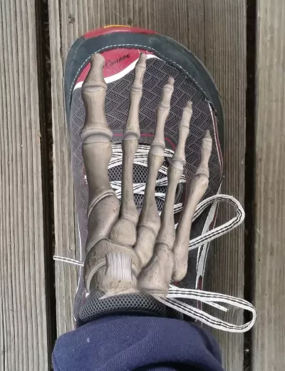 An overlay of the foot bones over an Altra running shoe.