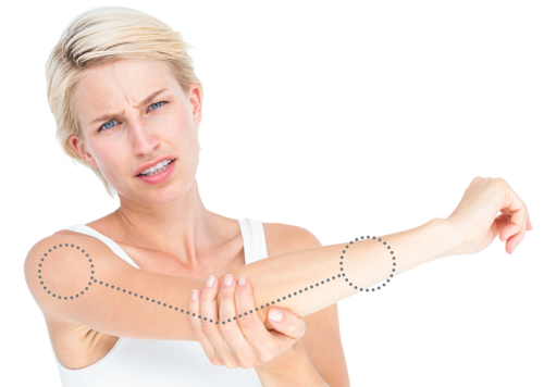 A woman holding their arm out cradling their elbow in pain. A line shows the direction of the affected muscles.