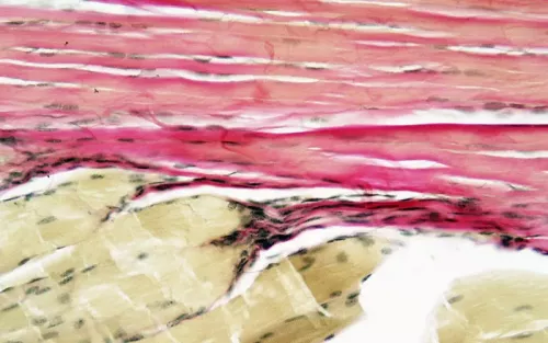 layers of pink and reddish and white connective tissue, muscles, and tendons at 40 times magnification.