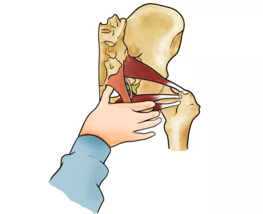 Drawing of a hand hooking and lifting the soft-tissue attachments near the coccyx.