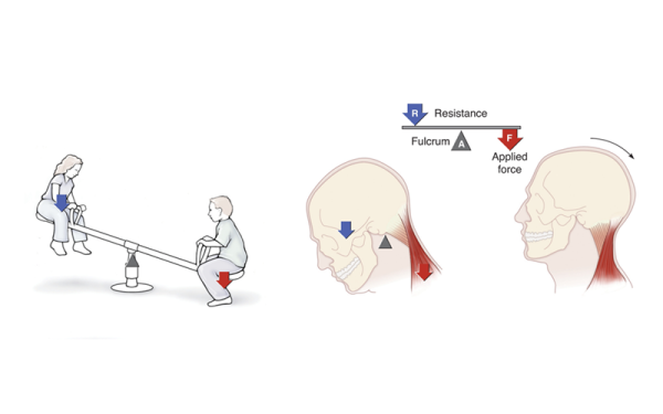 An example of a first-class lever, shown in the muscles at the back of the head and neck when the head is tilted.
