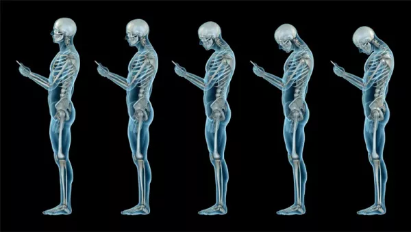 Lateral view of the evolution of a human skeleton standing straight then looking down with curved posture at a smartphone in hand.
