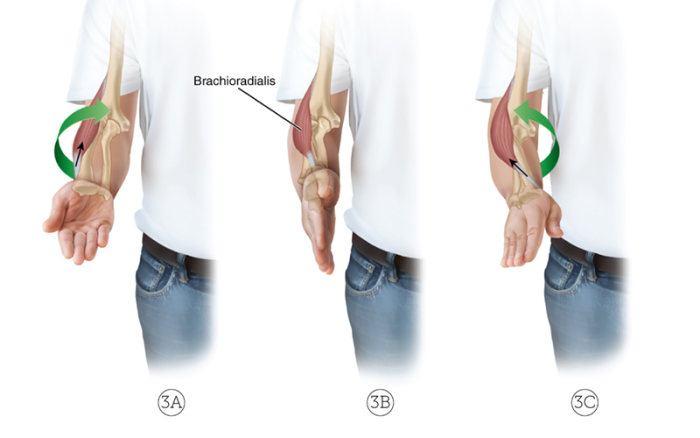 The Brachiradialis in images 3A through 3C, from full supination to half supination to full pronation.