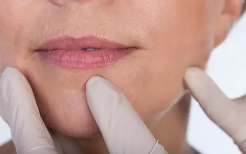 a medical professional wearing gloves touches a woman's face near her lip.