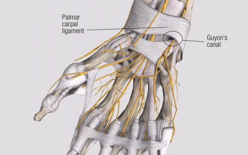 The palmar carpal ligament as the roof of Guyon's canal.