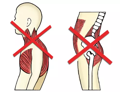 an example of cross syndrome in the upper body shoulder and the lower body pelvic area.