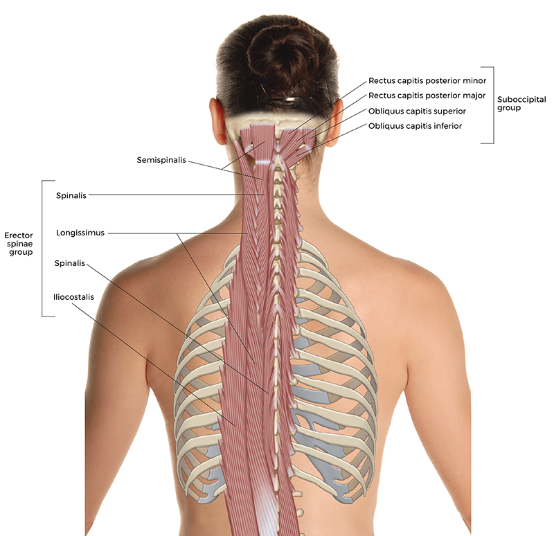 posterior view of deeper extensor muscles of the neck and back, like the spinalis, longissimus, and other erector spinae group muscles.