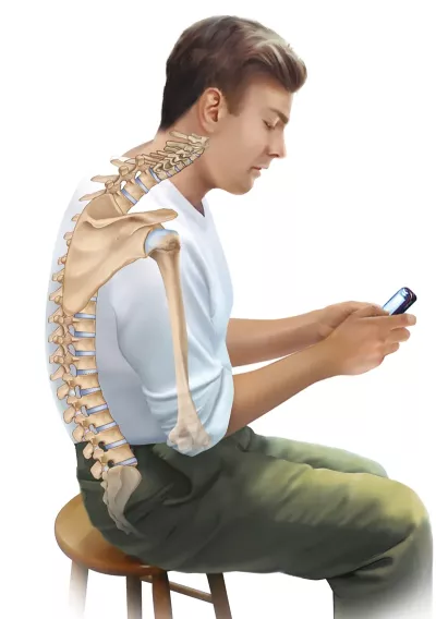 a man with bad, inward curved posture sits and types on his phone.