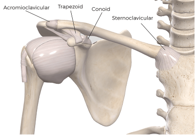 skeleton with 4 ligaments involved in shoulder separation labeled.