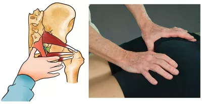 massage therapist's hands using ligaments as levers to help move the coccyx.