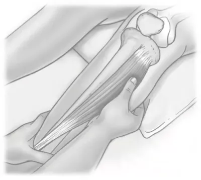 locating of stomach 36 acupressure point in the belly of the tibialis anterior muscle of the lower leg.