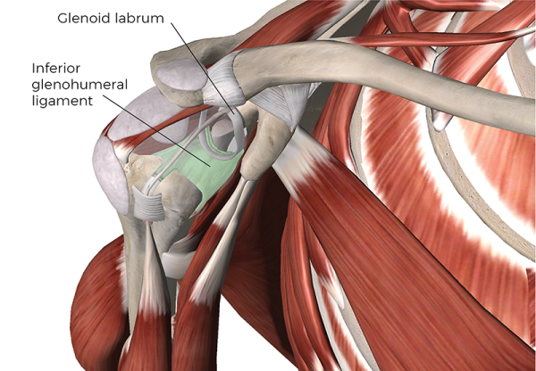 Bankart lesion on the inferior glenohumeral region of the scapula. 