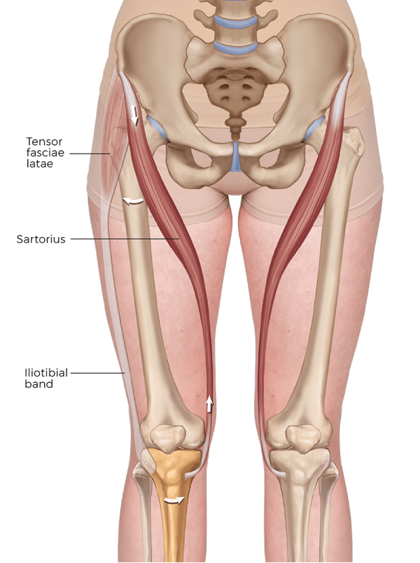 The sartorius muscle positioned in the upper leg, near the tensor fasciae latae and running opposite the iliotibial band.