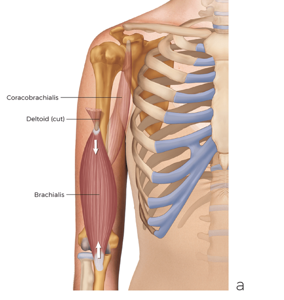 the brachialis muscle in the arm, near the deltoid.