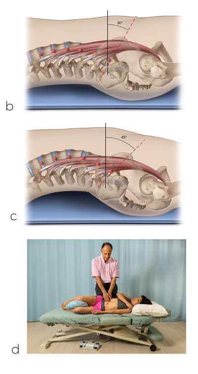 more images of the psoas major muscle and how it moves and tilts.