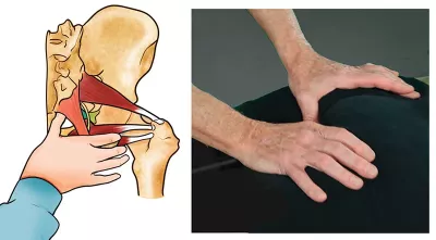 Laterial and anterior view as Erik Dalton's thumbs hook under the contralateral sacrotuberous ligaments and lift while the client performs a slow pelvic tilting movement.
