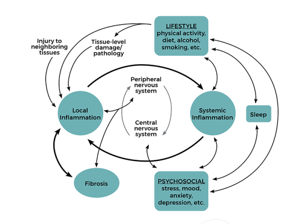 Explanatory diagram for myofascial pain syndromes.
