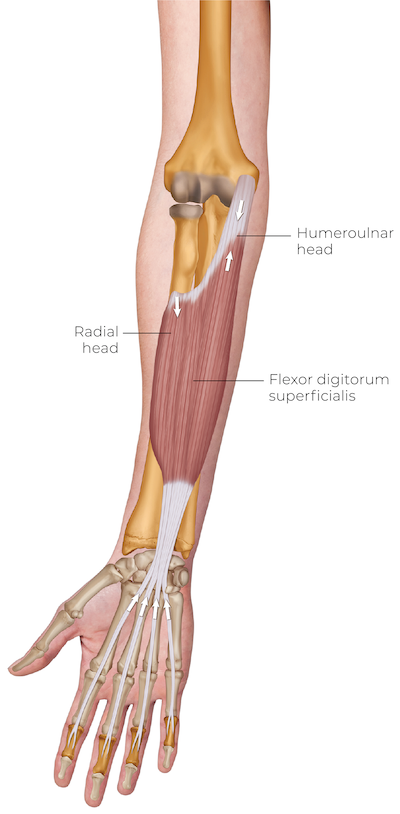 flexor digitorum superficialis in the forearm.