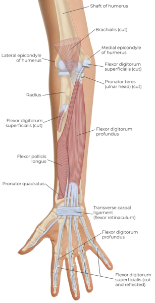 Anatomical illustration of the showing the flexor digitorum superficialis splitting to allow passage of the flexor digitorum profundus through it.