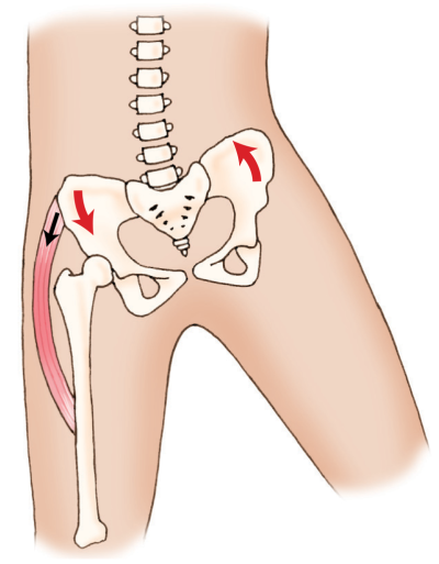 Closed-chain motion of the pelvis.
