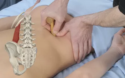 A massage therapist uses a tool on a client's back.