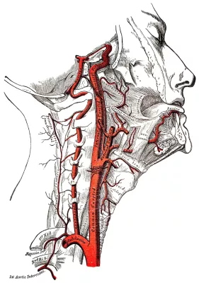 The common carotid artery is highlighted.