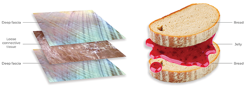 An image compares the microanatomy of the thoracolumbar fascia (left) to a jelly sandwich.