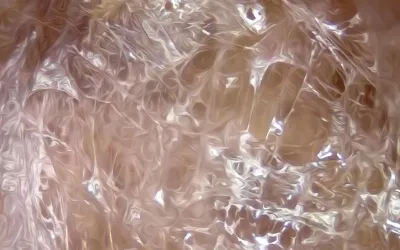 A magnified image of loose connective tissue.