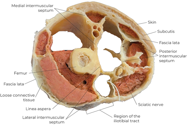 Cross-section of a human thigh. 