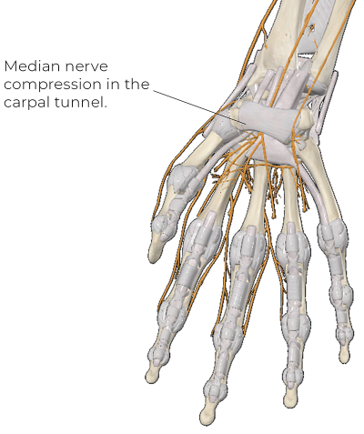 Illustration of a skeletal hand and the nerves around it.