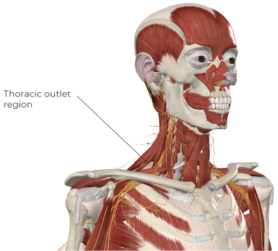 Skeletal and muscle illustration of a torso with the thoracic outlet region being indicated.