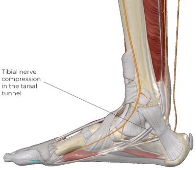 Musculo-skeletal illustration of the foot.