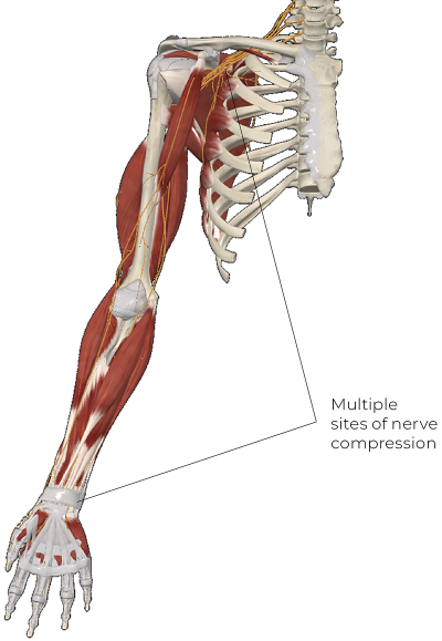 Musculo-skeletal illustration of the right arm and right upper-torso quadrant.